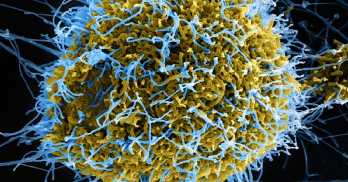 JUST IN: France Announces First Ebola Case